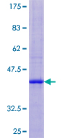 NDP Protein - 12.5% SDS-PAGE of human NDP stained with Coomassie Blue