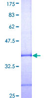 NDP Protein - 12.5% SDS-PAGE Stained with Coomassie Blue.