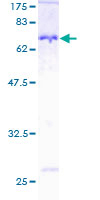 NDRG1 Protein - 12.5% SDS-PAGE of human NDRG1 stained with Coomassie Blue