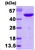 NDRG1 Protein