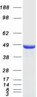 NDRG1 Protein - Purified recombinant protein NDRG1 was analyzed by SDS-PAGE gel and Coomassie Blue Staining