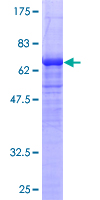 NDRG2 Protein - 12.5% SDS-PAGE of human NDRG2 stained with Coomassie Blue