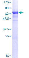 NDRG2 Protein - 12.5% SDS-PAGE of human NDRG2 stained with Coomassie Blue