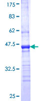 NDRG2 Protein - 12.5% SDS-PAGE Stained with Coomassie Blue.