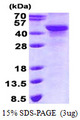 NDRG2 Protein