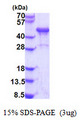 NDRG3 Protein