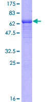 NDRG4 Protein - 12.5% SDS-PAGE of human NDRG4 stained with Coomassie Blue