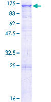 NDST1 Protein - 12.5% SDS-PAGE of human NDST1 stained with Coomassie Blue