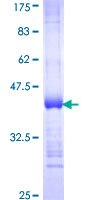NDST1 Protein - 12.5% SDS-PAGE Stained with Coomassie Blue.