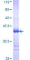 NDST1 Protein - 12.5% SDS-PAGE Stained with Coomassie Blue.