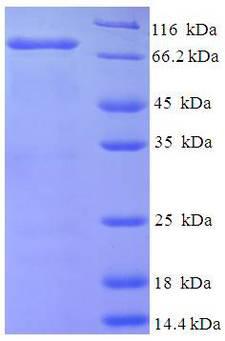 NDST1 Protein