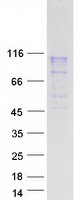 NDST1 Protein - Purified recombinant protein NDST1 was analyzed by SDS-PAGE gel and Coomassie Blue Staining