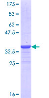 NDST2 Protein - 12.5% SDS-PAGE Stained with Coomassie Blue.