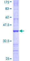 NDST3 Protein - 12.5% SDS-PAGE Stained with Coomassie Blue.