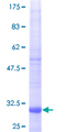 NDUFA1 Protein - 12.5% SDS-PAGE of human NDUFA1 stained with Coomassie Blue
