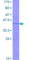 NDUFA11 / B14.7 Protein - 12.5% SDS-PAGE of human NDUFA11 stained with Coomassie Blue