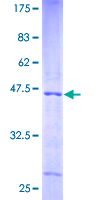 NDUFA12 / B17.2 Protein - 12.5% SDS-PAGE of human NDUFA12 stained with Coomassie Blue