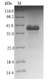 NDUFA12 / B17.2 Protein - (Tris-Glycine gel) Discontinuous SDS-PAGE (reduced) with 5% enrichment gel and 15% separation gel.