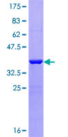 NDUFA2 Protein - 12.5% SDS-PAGE of human NDUFA2 stained with Coomassie Blue