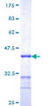 NDUFA2 Protein - 12.5% SDS-PAGE Stained with Coomassie Blue.