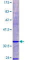 NDUFA3 / B9 Protein - 12.5% SDS-PAGE of human NDUFA3 stained with Coomassie Blue