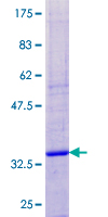 NDUFA4 Protein - 12.5% SDS-PAGE of human NDUFA4 stained with Coomassie Blue