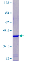 NDUFA5 Protein - 12.5% SDS-PAGE of human NDUFA5 stained with Coomassie Blue