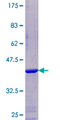 NDUFA5 Protein - 12.5% SDS-PAGE of human NDUFA5 stained with Coomassie Blue