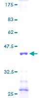NDUFA6 Protein - 12.5% SDS-PAGE of human NDUFA6 stained with Coomassie Blue