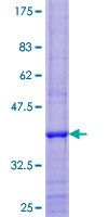 NDUFA7 Protein - 12.5% SDS-PAGE of human NDUFA7 stained with Coomassie Blue