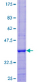 NDUFA7 Protein - 12.5% SDS-PAGE of human NDUFA7 stained with Coomassie Blue