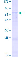NDUFA9 Protein - 12.5% SDS-PAGE of human NDUFA9 stained with Coomassie Blue