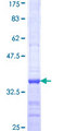 NDUFA9 Protein - 12.5% SDS-PAGE Stained with Coomassie Blue.