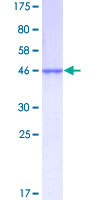 NDUFAB1 / ACP Protein - 12.5% SDS-PAGE of human NDUFAB1 stained with Coomassie Blue