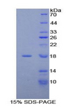 NDUFAB1 / ACP Protein - Recombinant Acyl Carrier Protein, Mitochondrial By SDS-PAGE