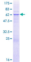NDUFAF1 / CIA30 Protein - 12.5% SDS-PAGE of human NDUFAF1 stained with Coomassie Blue