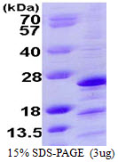 NDUFAF2 / NDUFA12L Protein