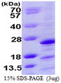 NDUFAF2 / NDUFA12L Protein