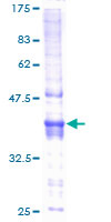 NDUFAF5 Protein - 12.5% SDS-PAGE of human C20orf7 stained with Coomassie Blue