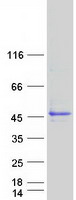 NDUFAF5 Protein - Purified recombinant protein NDUFAF5 was analyzed by SDS-PAGE gel and Coomassie Blue Staining