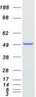 NDUFAF7 Protein - Purified recombinant protein NDUFAF7 was analyzed by SDS-PAGE gel and Coomassie Blue Staining