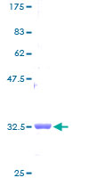 NDUFB1 / MNLL Protein - 12.5% SDS-PAGE of human NDUFB1 stained with Coomassie Blue