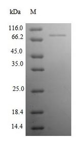 NDUFB10 Protein - (Tris-Glycine gel) Discontinuous SDS-PAGE (reduced) with 5% enrichment gel and 15% separation gel.