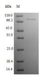 NDUFB10 Protein - (Tris-Glycine gel) Discontinuous SDS-PAGE (reduced) with 5% enrichment gel and 15% separation gel.