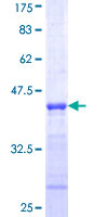 NDUFB10 Protein - 12.5% SDS-PAGE Stained with Coomassie Blue.