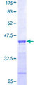 NDUFB10 Protein - 12.5% SDS-PAGE Stained with Coomassie Blue.
