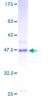 NDUFB11 Protein - 12.5% SDS-PAGE of human NDUFB11 stained with Coomassie Blue