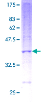 NDUFB3 Protein - 12.5% SDS-PAGE of human NDUFB3 stained with Coomassie Blue