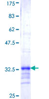 NDUFB3 Protein - 12.5% SDS-PAGE Stained with Coomassie Blue.