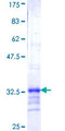 NDUFB3 Protein - 12.5% SDS-PAGE Stained with Coomassie Blue.